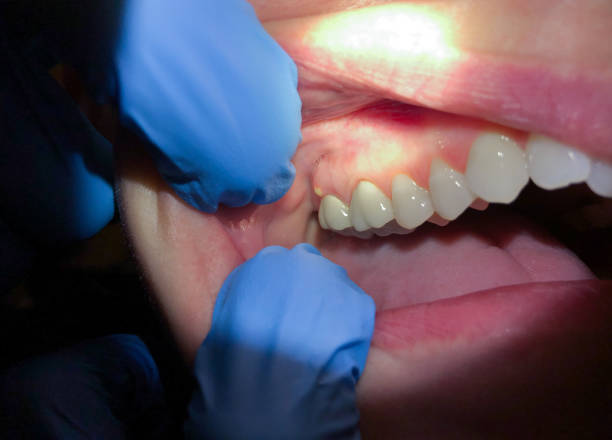 Best Cracked Tooth Emergency Dentist  in Portales, NM